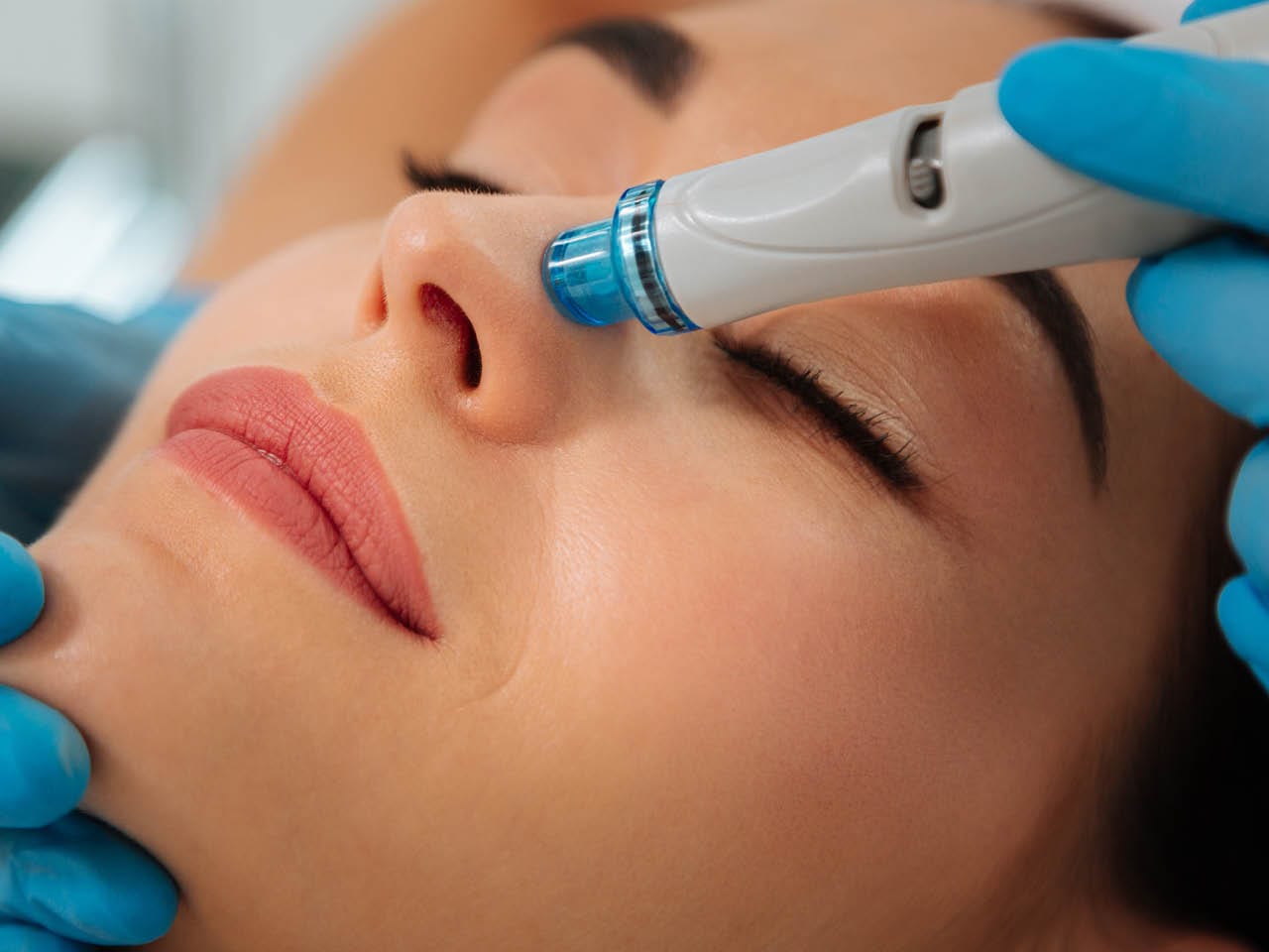 hydrafacial-benefits